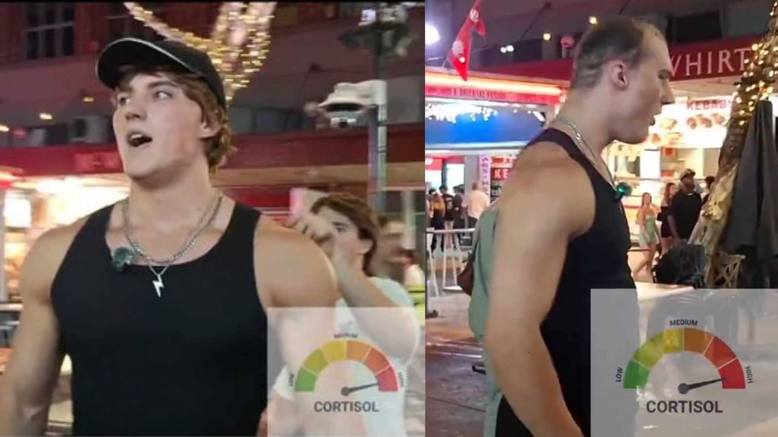 Chad Androgenic Exposed With Wig