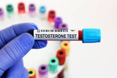 Doctor holding blood tube for analysis of Testosterone